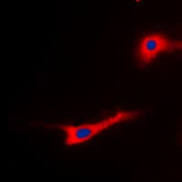 EEF2 / Elongation Factor 2 Antibody (N-Terminus)