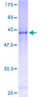 Human CDK4 Protein (Recombinant GST)
