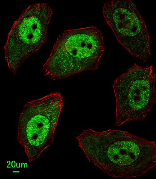 Polyclonal Rabbit anti-Human APEX2 Antibody (aa143-171, IHC, IF, WB)