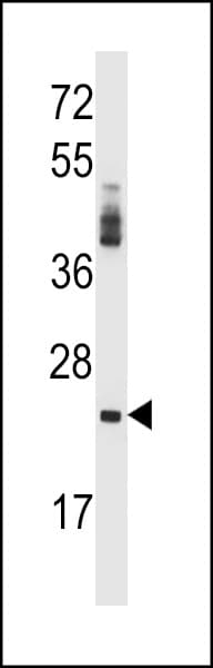 PRSS2 / Trypsin 2 Antibody (aa80-108)