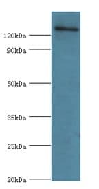 USP8 / UBPY Antibody (aa1-270)