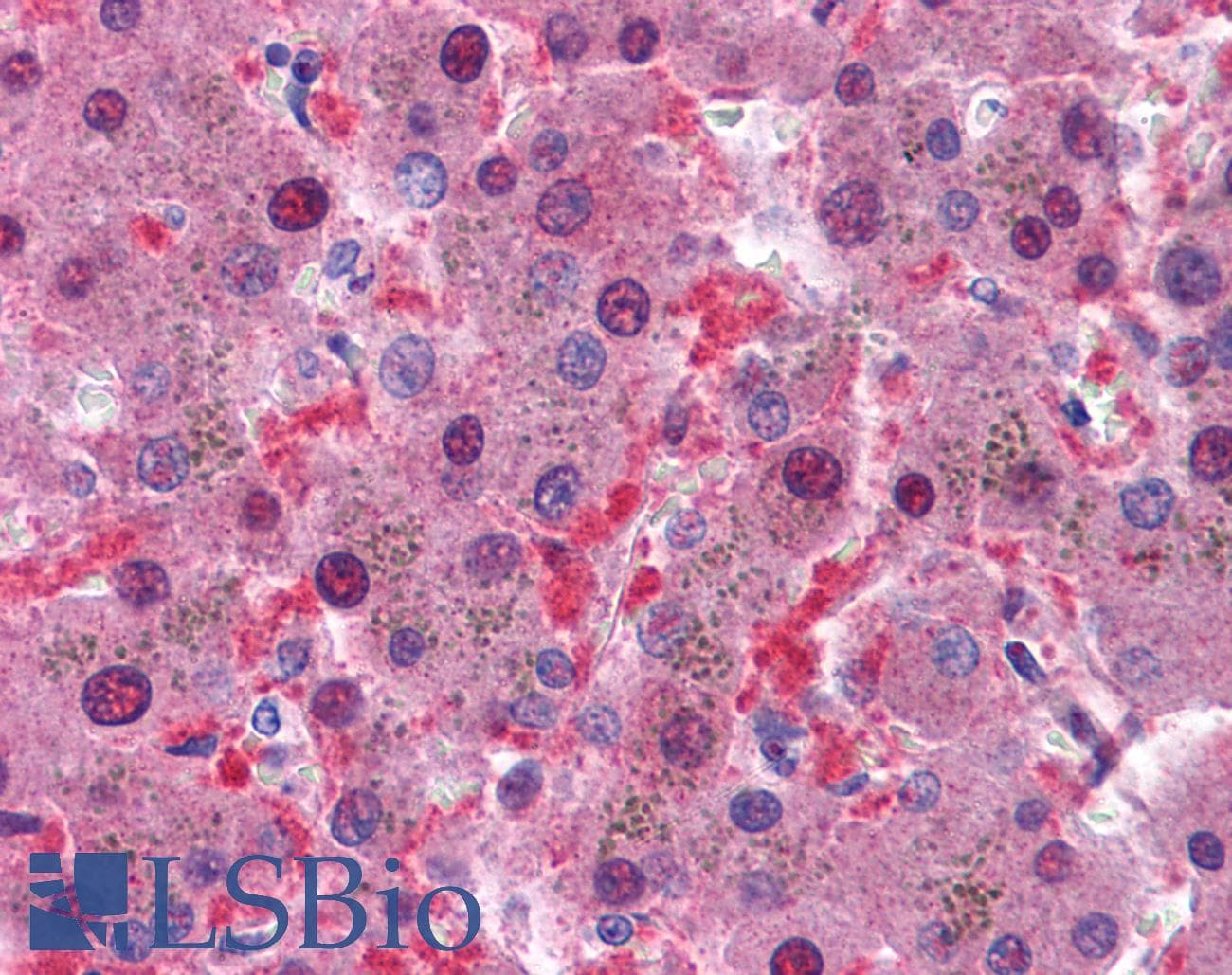IHC-plus™ IDH1 / IDH Antibody