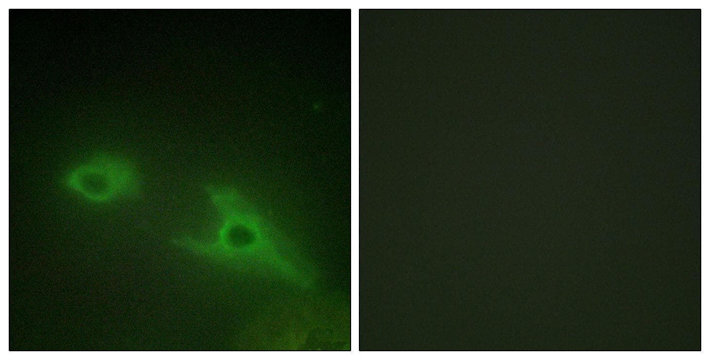EPHA1 / EPH Receptor A1 Antibody