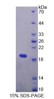 Human TIAM1 Protein (Recombinant His-T7)