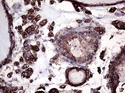GNAS Antibody (clone OTI13D7)