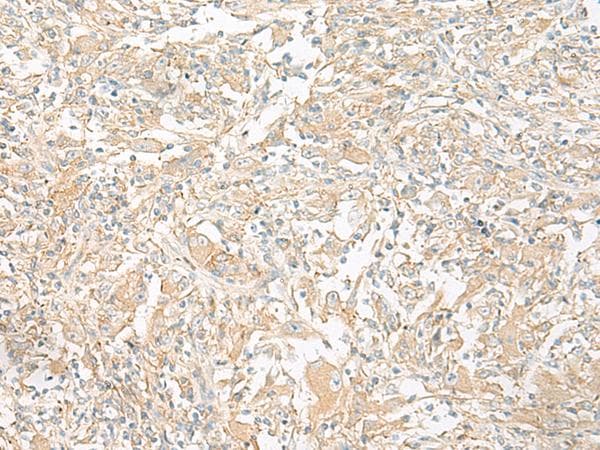 Polyclonal Rabbit anti-Human GP6 / GPVI Antibody (IHC)