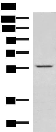 Polyclonal Rabbit anti-Human IPPK Antibody (IHC, WB)