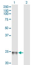 RAB1B Antibody (clone 1B2)