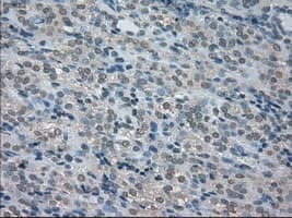 BUB1B / BubR1 Antibody (clone OTI11G2)