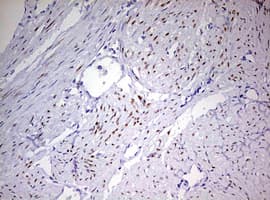 Monoclonal Mouse anti-Human PR / Progesterone Receptor Antibody (clone OTI11E8, aa1-298, IHC, WB)