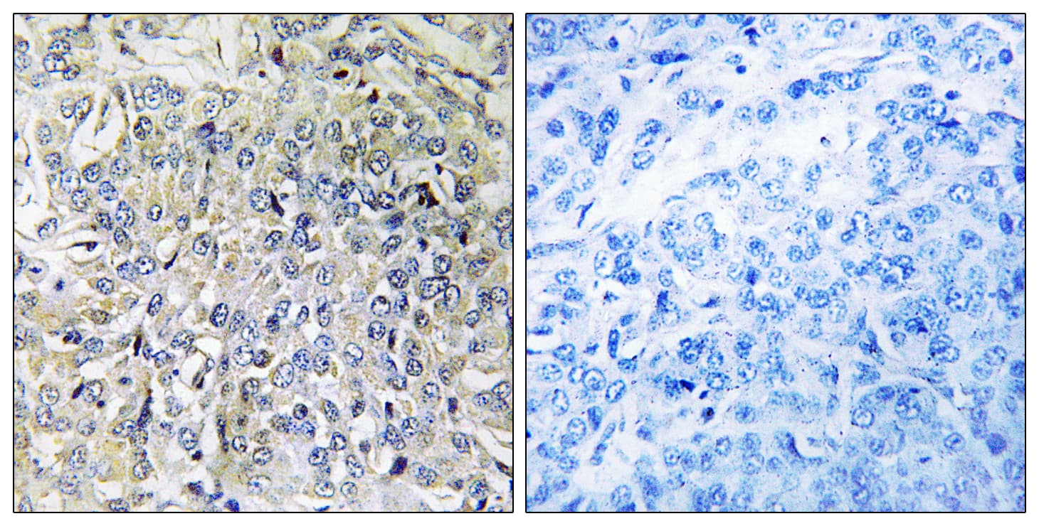 CSGALNACT2 Antibody (aa61-110)