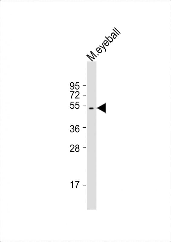 Polyclonal Rabbit anti-Human SAG / Arrestin Antibody (aa273-307, WB)