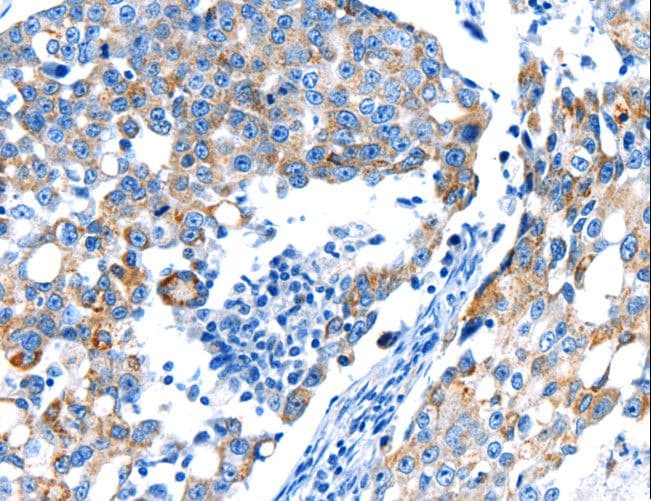 Polyclonal Rabbit anti-Human POMC / Proopiomelanocortin Antibody (IHC, WB)