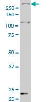 SMG1 / ATX Antibody (clone 1C12)