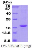Human HBA2 / Hemoglobin Alpha 2 Protein (Recombinant His)