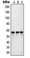 SLC1A1 / EAAT3 Antibody (Internal)