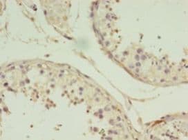 GIF / Intrinsic Factor Antibody (aa19-417)