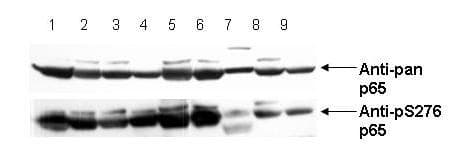 RELA / NFKB p65 Antibody (phospho-Ser276)
