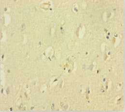 GABRQ / THETA Antibody