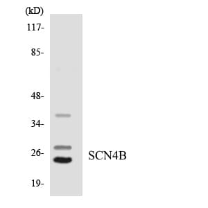 Polyclonal Rabbit anti-Human SCN4B Antibody (aa6-55, WB)