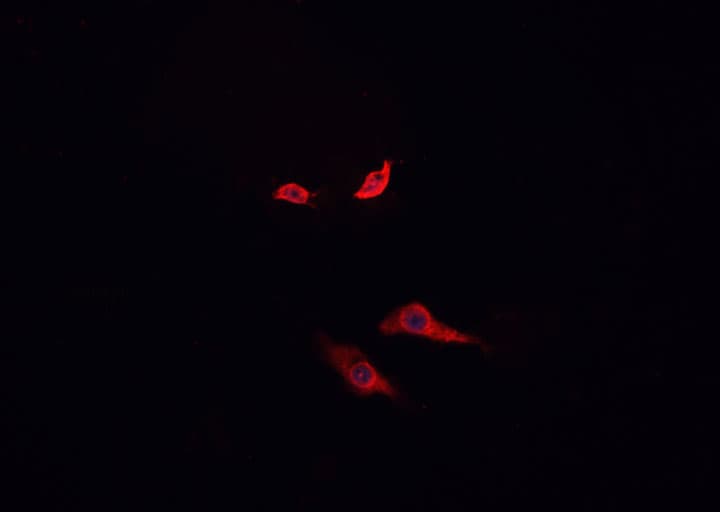 ANO7 / TMEM16G / NGEP Antibody