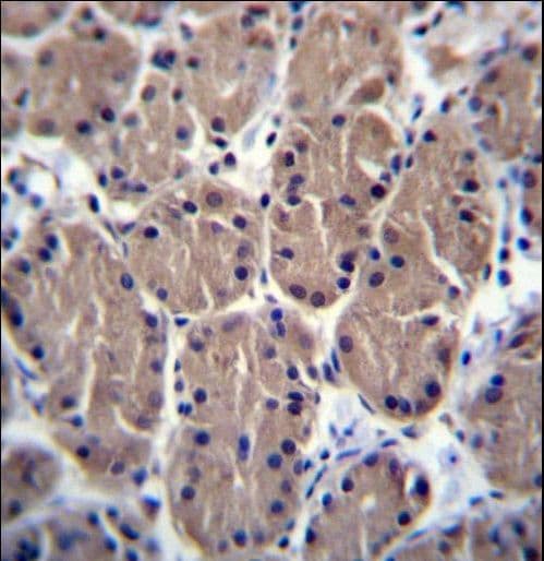 POLR1B Antibody (aa89-117)