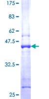 Human PFDN5 / MM1 Protein (Recombinant GST)