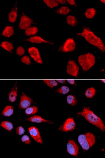 CBS Antibody
