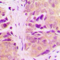 MRPL18 Antibody (N-Terminus)
