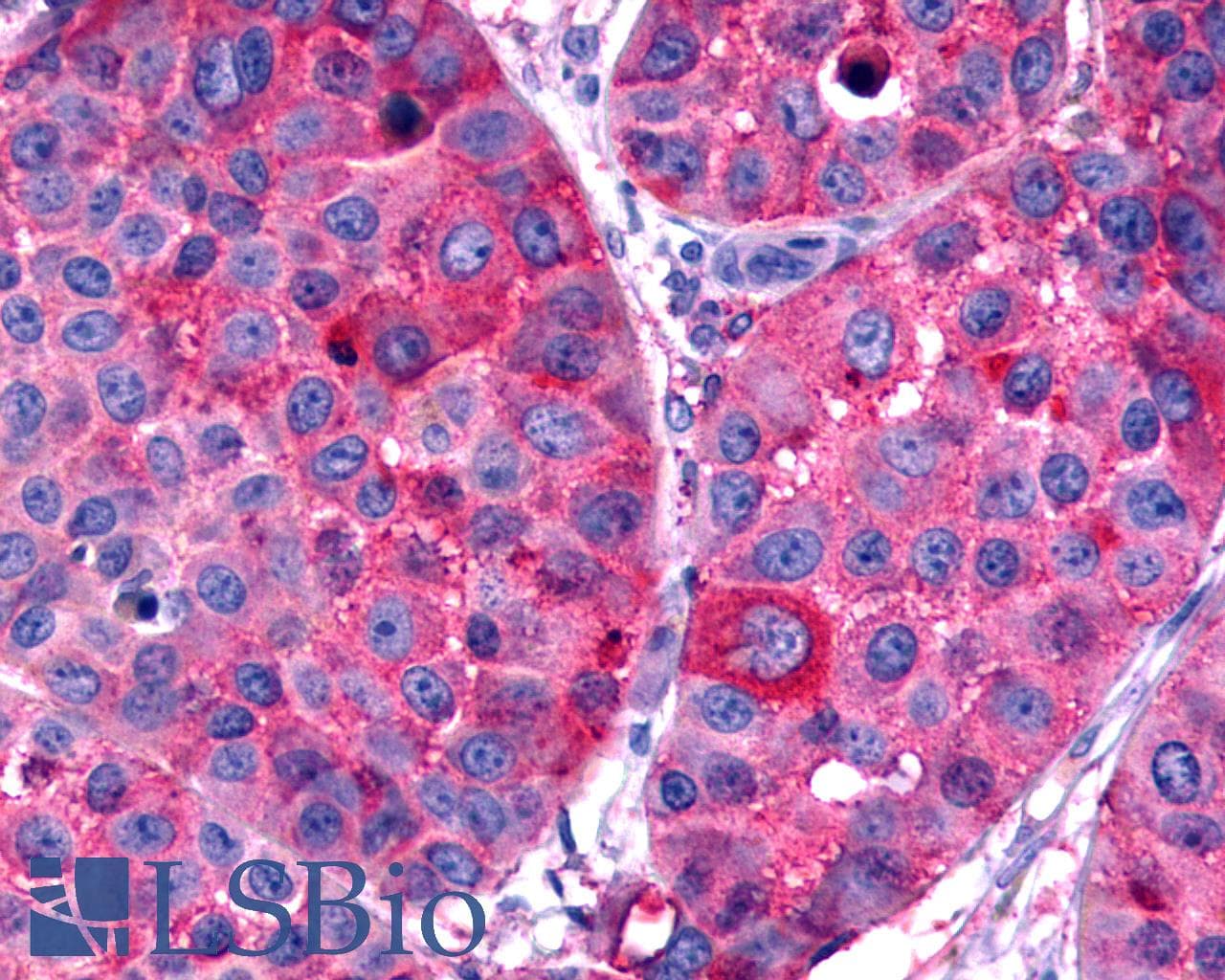 IHC-plus™ FZD7 / Frizzled 7 Antibody (N-Terminus)