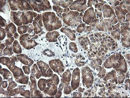 MAP2K1 / MKK1 / MEK1 Antibody (clone OTI2E8)