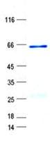 Human SFRP2 Protein (Recombinant GST, N-terminus + His, C-terminus)