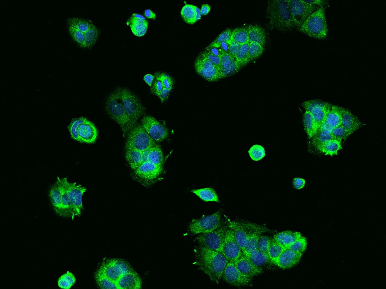RPS10 / Ribosomal Protein S10 Antibody