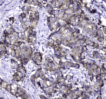 Polyclonal Rabbit anti-Human MAC-2-BP / LGALS3BP Antibody (IHC, WB)