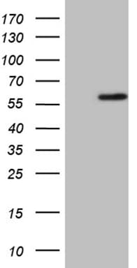 Monoclonal Mouse anti-Human Zfp105 / ZNF35 Antibody (clone OTI4A2, aa1-258, WB)