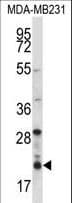 HIST1H1D Antibody (aa135-164)