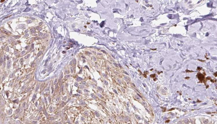 RELN / Reelin Antibody
