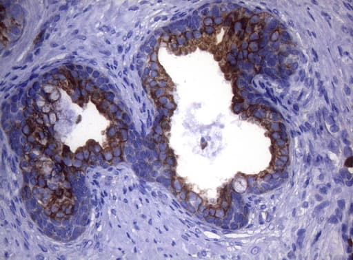 KRT18 / CK18 / Cytokeratin 18 Antibody (aa69-372, clone OTI5E4, Carrier-free)