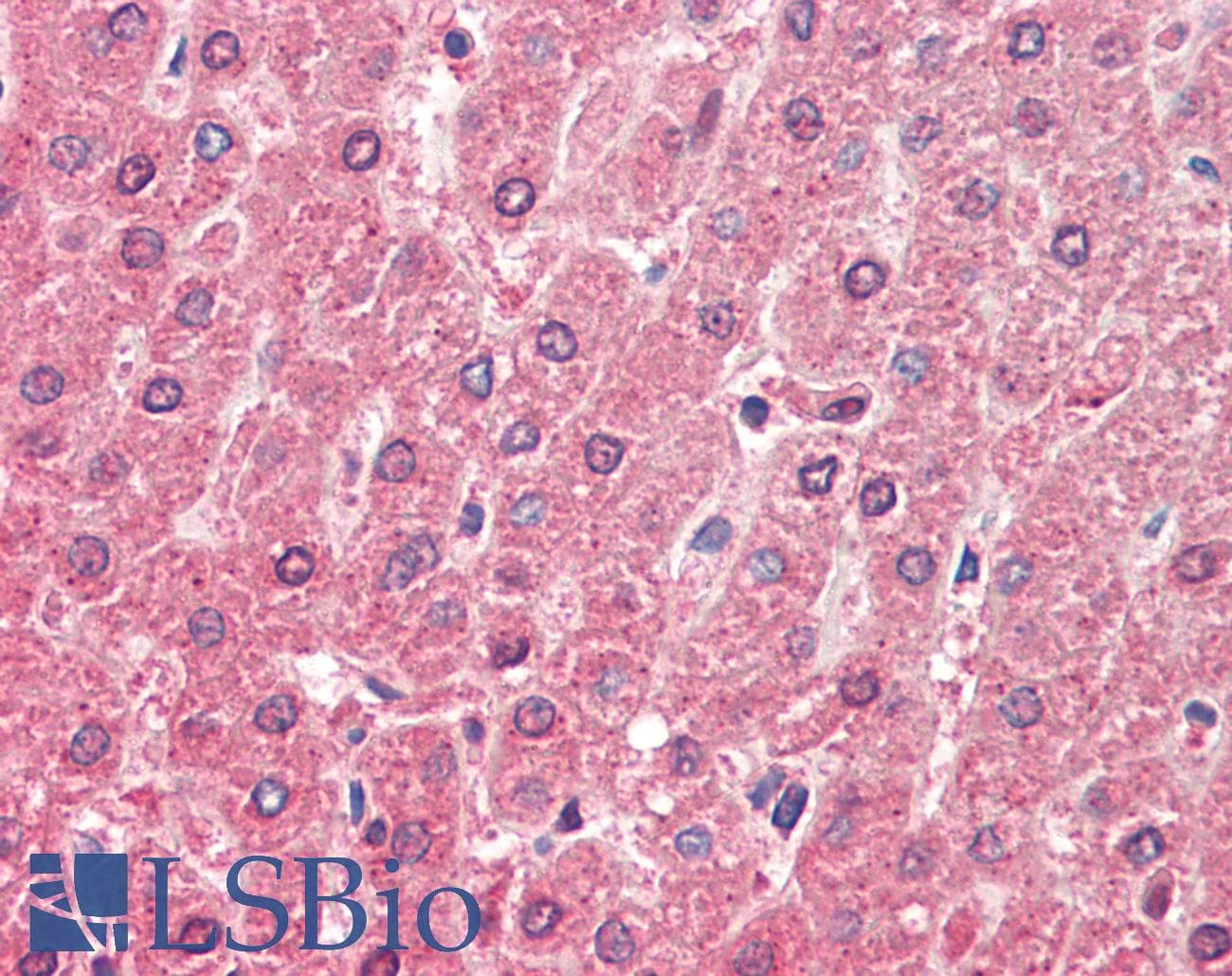 IHC-plus™ ALDH6A1 Antibody (aa262-272)