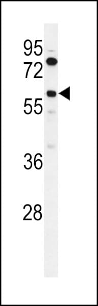 ACSBG2 Antibody (aa237-265)