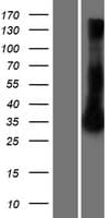 RRAD Protein (Over-Expression Lysate Myc-DDK (Flag))