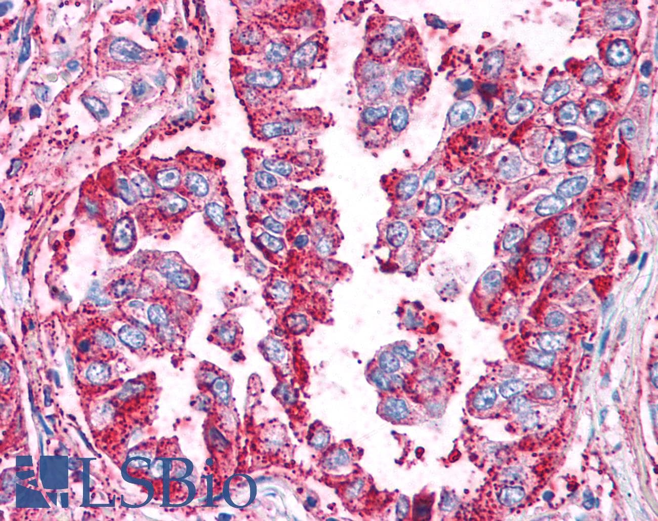 IHC-plus™ WNT5B Antibody (Internal)
