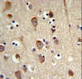 Polyclonal Rabbit anti-Human LUC7L2 Antibody (aa341-369, IHC, WB)
