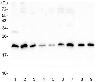 Polyclonal Rabbit anti-Human SRI / Sorcin Antibody (IHC, WB)