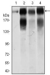 IHC-plus™ ITGB4 / Integrin Beta 4 Antibody (aa1619-1822, clone 10B10D5)