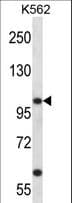 Polyclonal Rabbit anti-Human KCNC3 / Kv3.3 Antibody (aa639-667, WB)