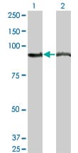 AMPD2 Antibody (clone 2G8)
