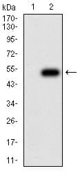 ITGB4 / Integrin Beta 4 Antibody (clone 1D6B4)