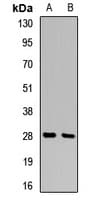 PathPlus™ SFN / Stratifin / 14-3-3 Sigma Antibody