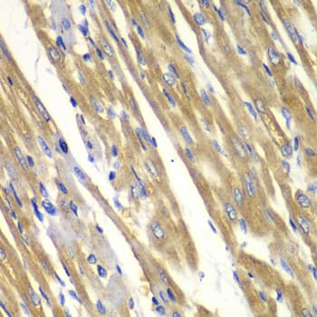 Tyrosinase Antibody